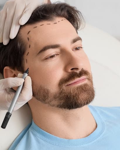 Precision Hairline Design